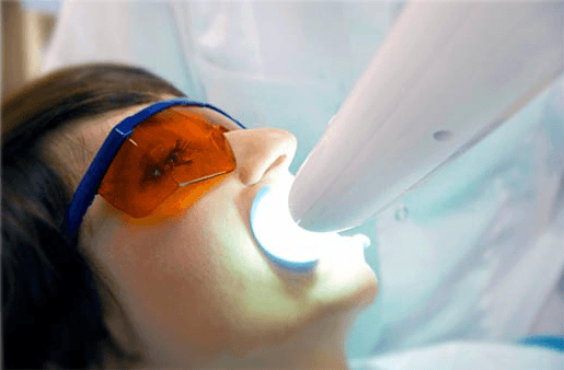 Understanding the Causes of Teeth Sensitivity Hove