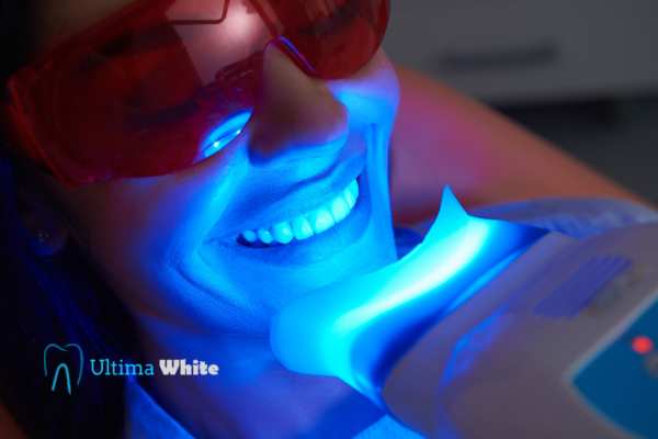 Professional Teeth Whitening Options Hove