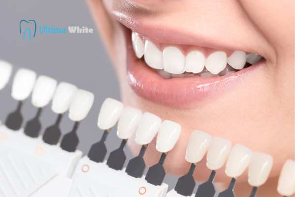 How to Maximise the Results of Your Laser Teeth Whitening Treatment Hove