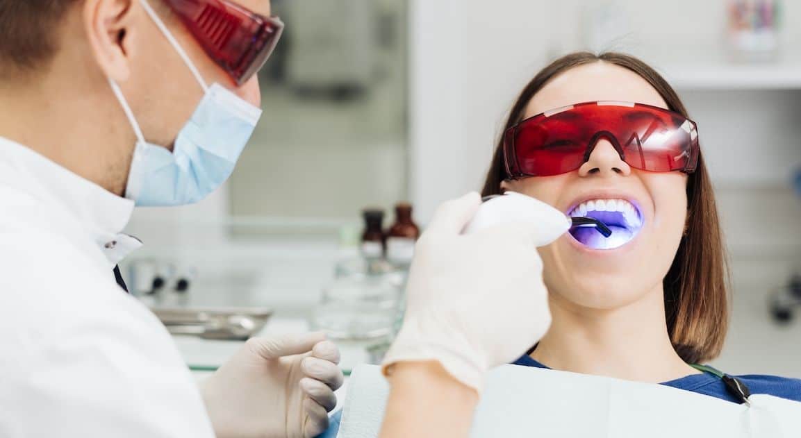 Do Dental Crowns Change Colour After Teeth Whitening Hove?