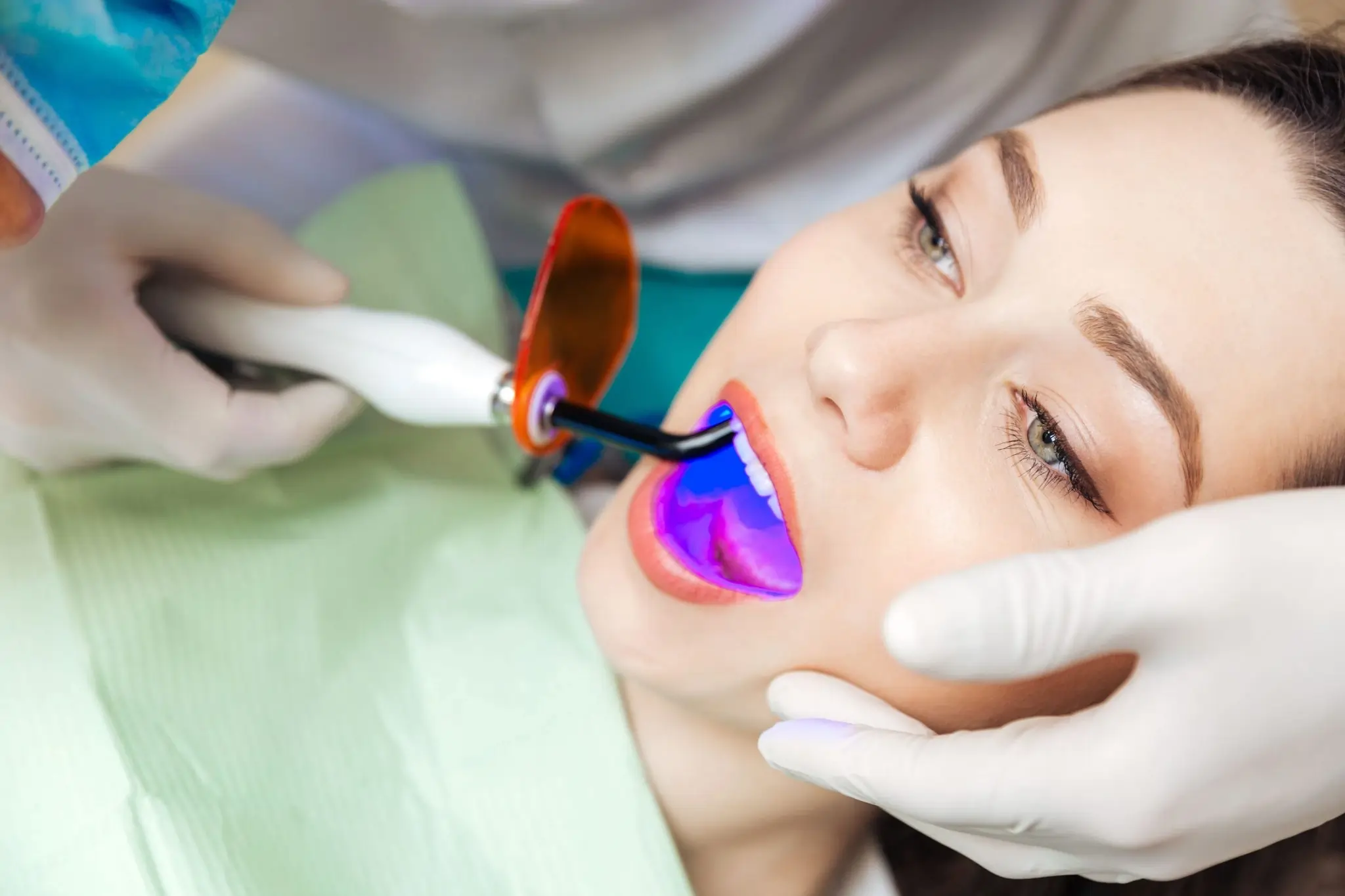 What You Need to Know Before Brightening Your Smile Hove