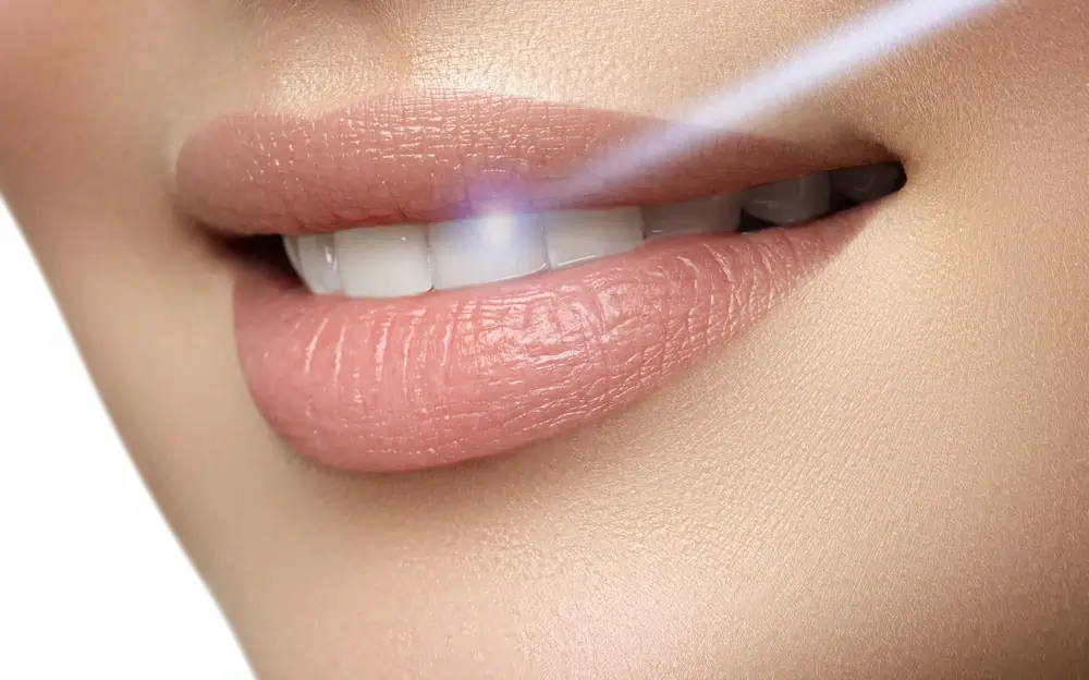 Understanding Teeth Whitening Risks and Results Hove