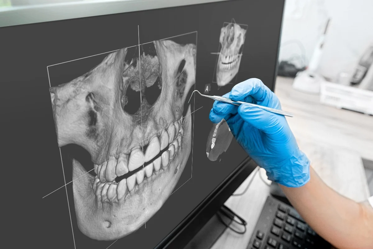 How Is AI Transforming Dental Treatment Planning Hove?