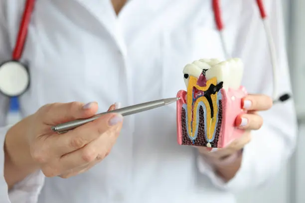 Which Whitening Methods Are Gentler on Sensitive Teeth Hove?