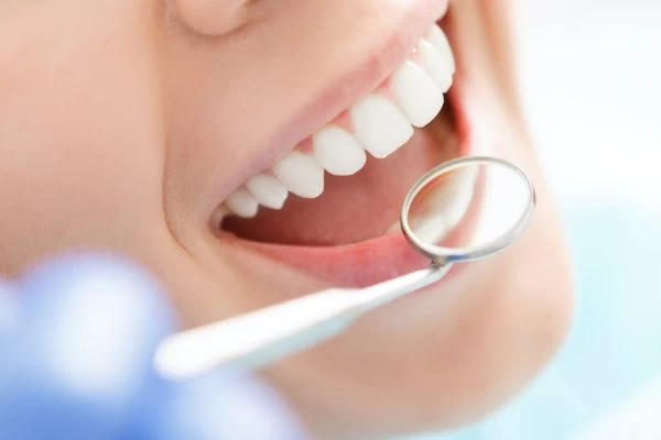 Can Your Smile Really Affect Your Confidence Hove?
