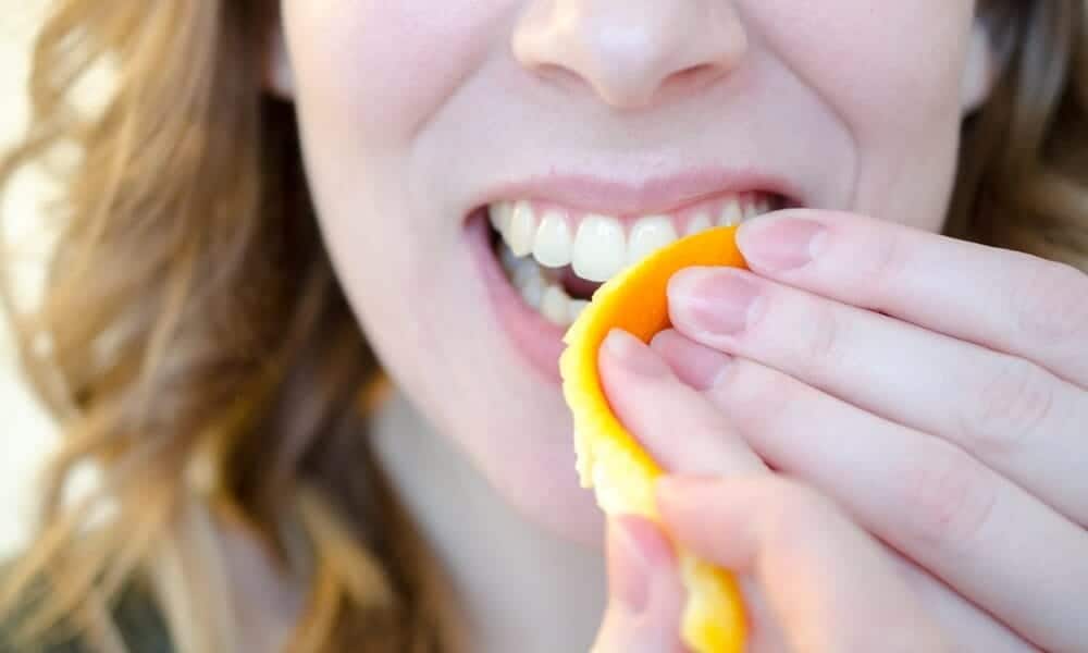 Cultural Insights into Natural Teeth Whitening: A Global Perspective Hove