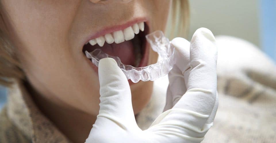 Can Bruxism Affect Your Sleep Quality Hove