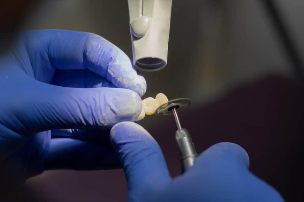 Customised Dental Solutions: Crowns, Aligners, and Implants Hove