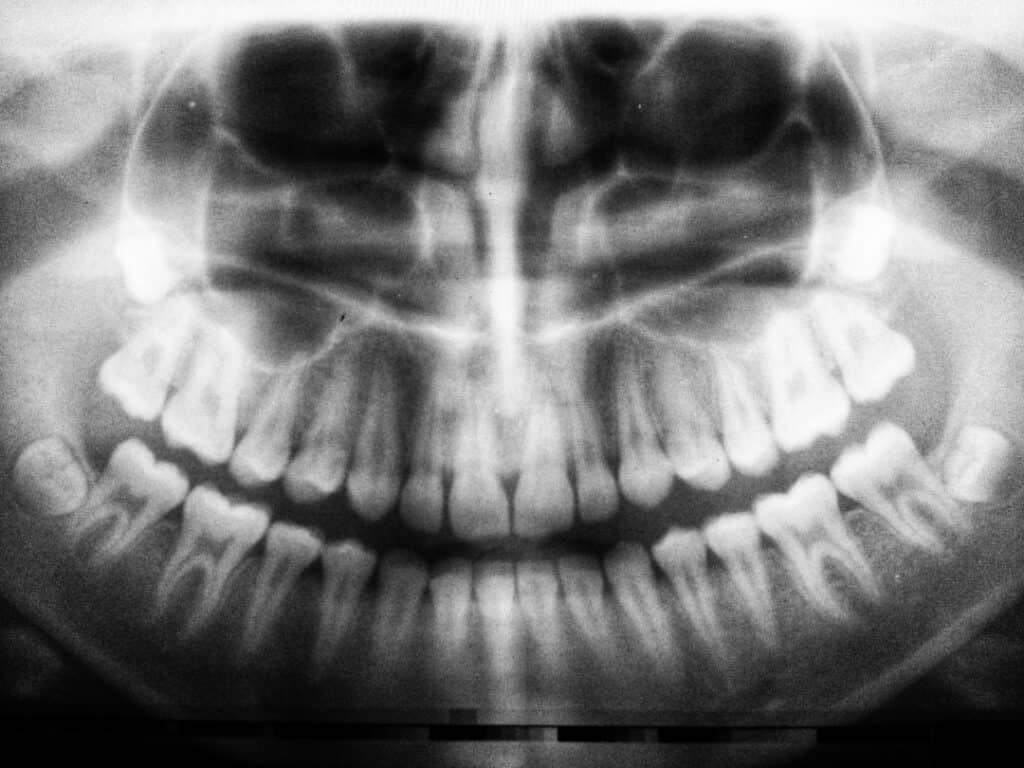 The Future of 3D Printing in Oral Healthcare Hove
